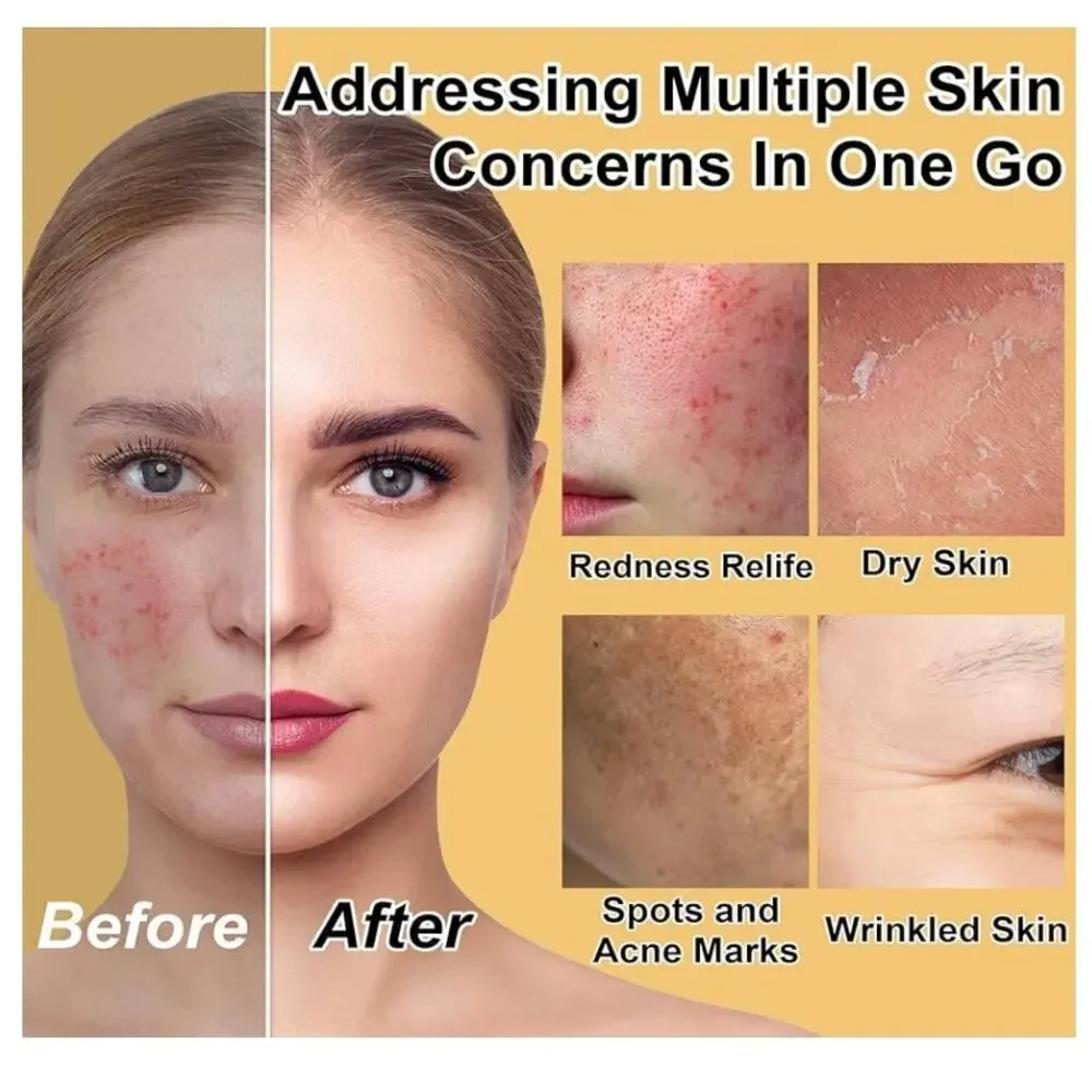 NEW Gowlaver Deep Hydration Repairing Skin Care Set | 6-Piece Kit | Gift Travel‎